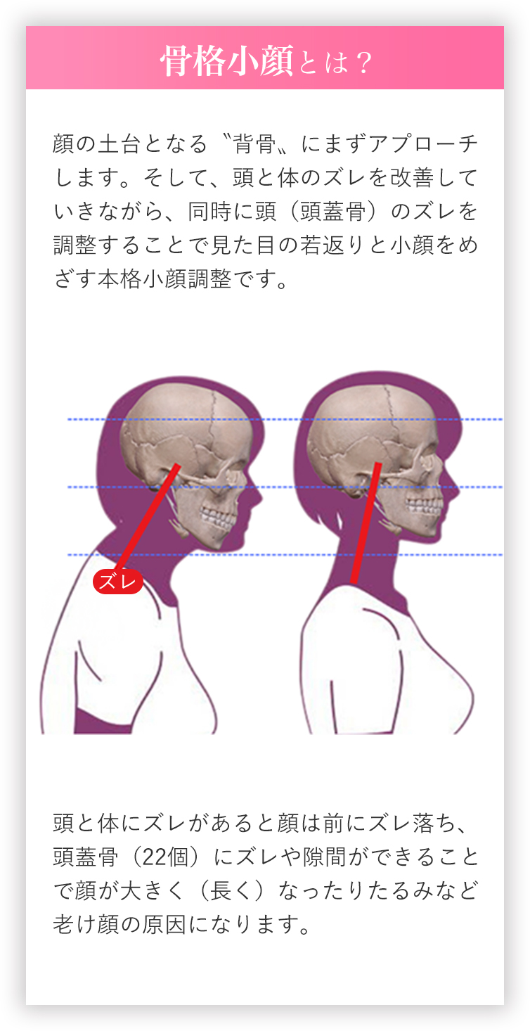 骨格小顔とは？